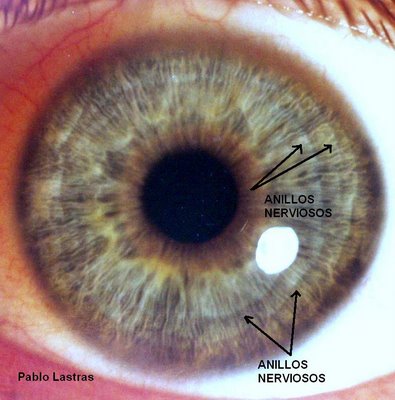 Iridologia: Anillos nerviosos